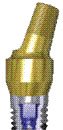 Failed Dental Implants- Causes and Treatments 4 Failed Dental Implants 4
