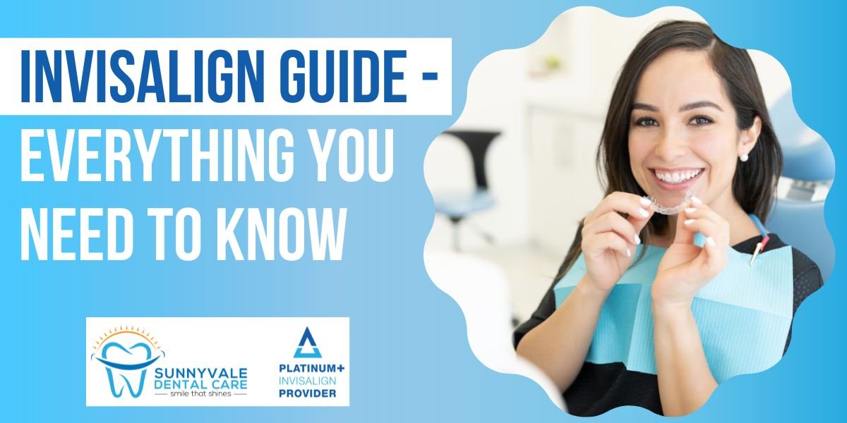 Invisalign Guide - Everything You Need to Know 1 Invisalign guide - everything you need to know