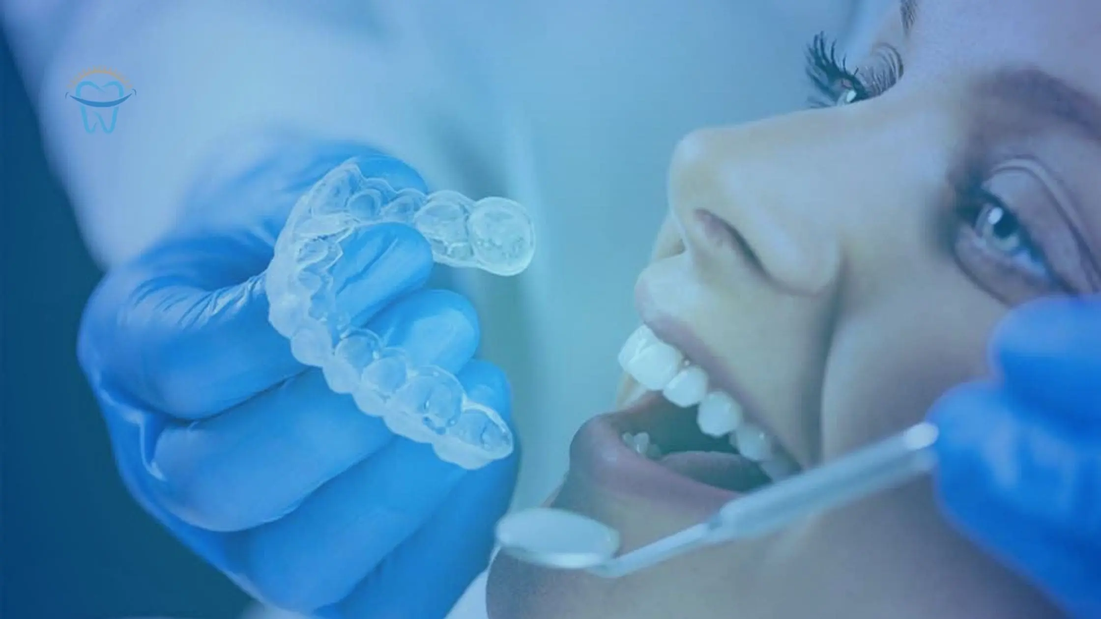 How to Clean Invisalign Retainers: A Comprehensive Guide 5 How-to-select-right-Invisalign-dentist-in-Sunnyvale