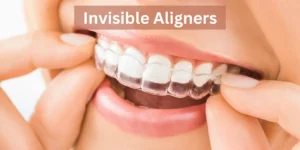 What is Teeth Gap: How to Fix Your Diastema? 2 Invisible Aligners as Teeth Gap (Diastema) Treatments