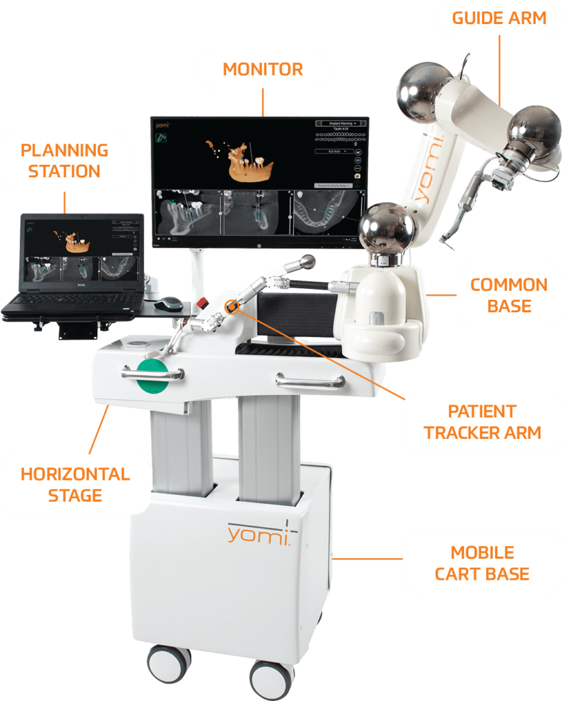 Yomi Robotic Dental Implants: The Future of Dentistry in Sunnyvale 4 Yomi Robotic Dental Implants The Future of Dentistry in Sunnyvale