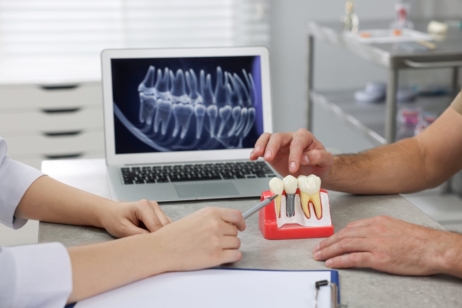 Can You Get Advanced Dental Implants in Just One Day? 10 Perfect Smile 12