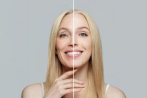 Foods that are Safe to Consume Post an Oral Surgery 7 Prevent Premature Facial Aging After Tooth Loss with Professional Implant Care