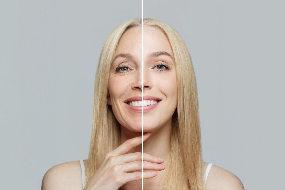 Prevent Premature Facial Aging After Tooth Loss with Professional Implant Care 6 Prevent Premature Facial Aging After Tooth Loss with Professional Implant Care